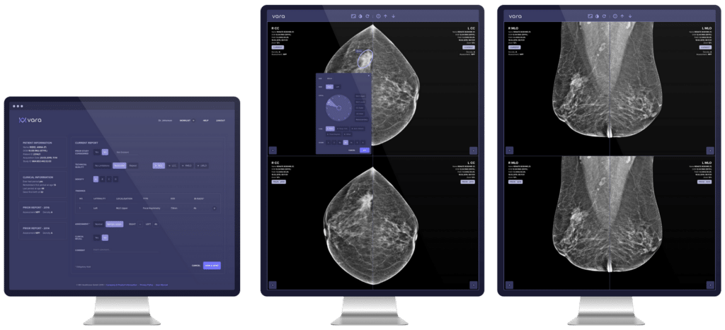 Vara Screening